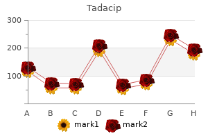 purchase tadacip 20mg without a prescription