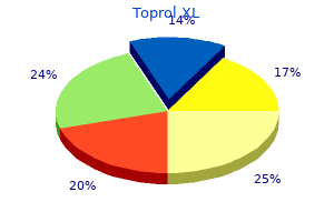 generic toprol xl 25mg mastercard