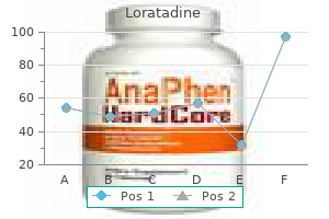 loratadine 10mg amex